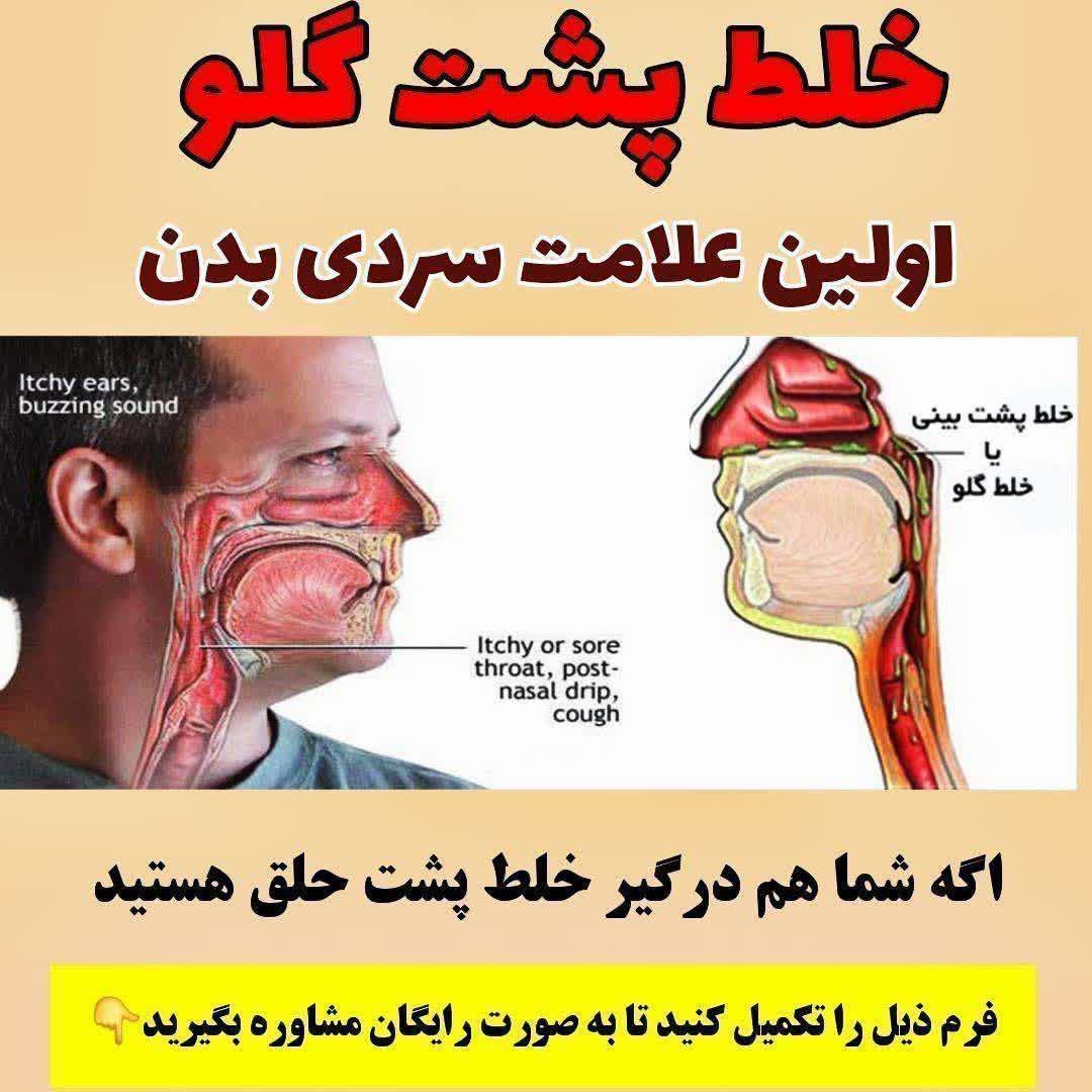 خلط پشت گلو ریشه اصلی: بلغم در قسمت سر هست. هیچ...