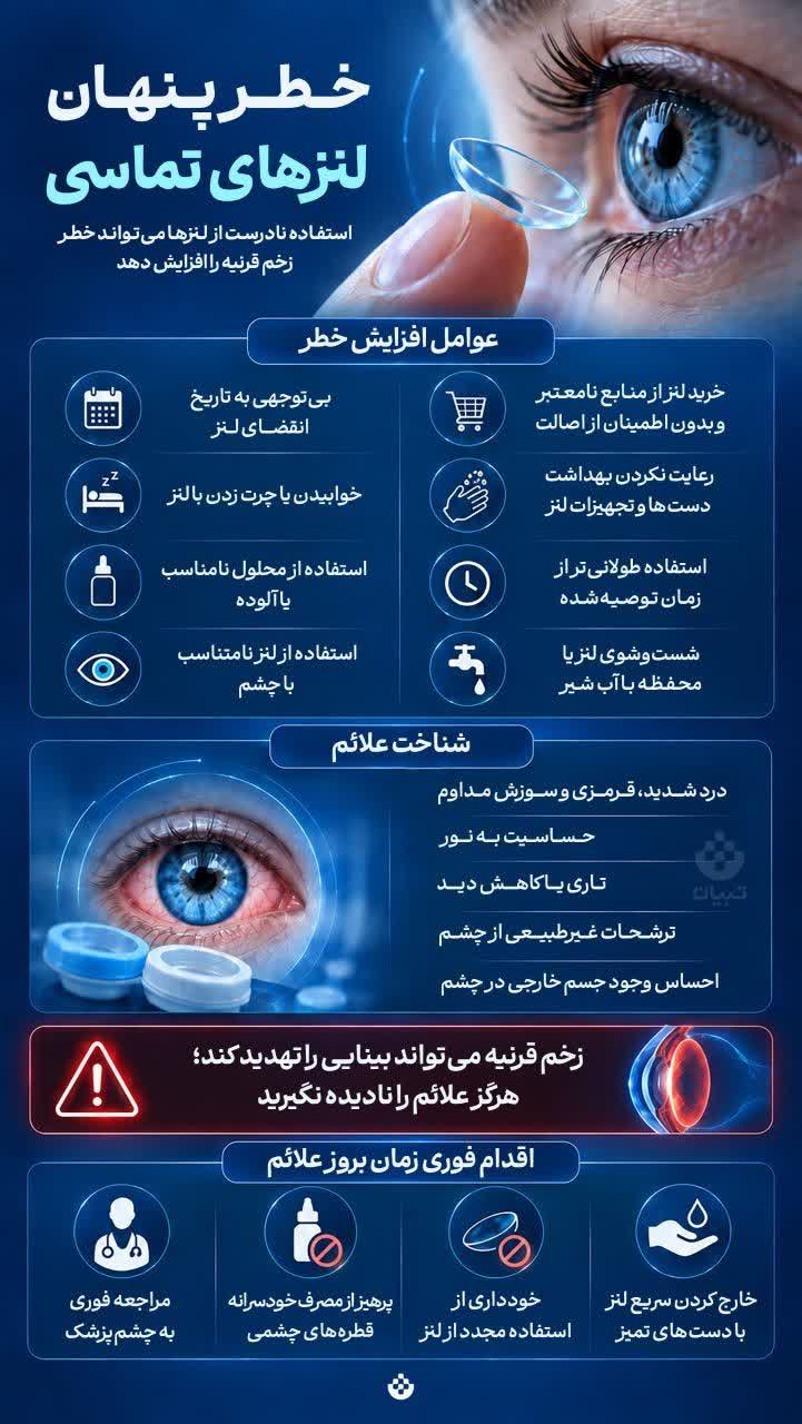 هشدار درباره خطر عفونت و زخم قرنیه در اثر استفاده نادرست از لنز تماسی